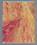 Hypo (Sodium Thiosulfate) x600, Lewis R. Wolberg  American, Chromogenic print