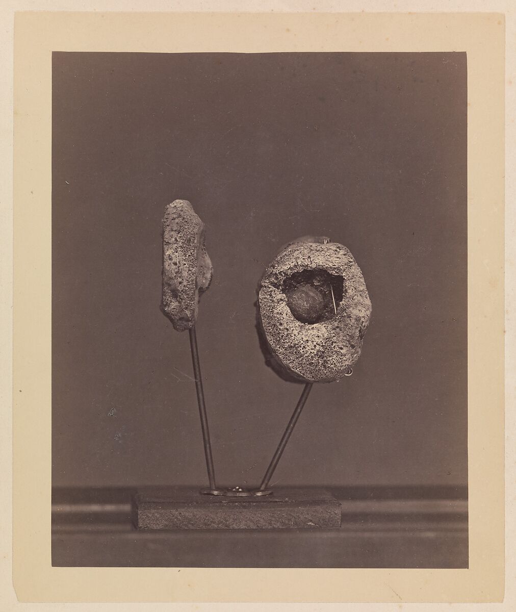 Excised Knee Joint. A Round Musket Ball in the Inner Condyle of the Right Femur [Gardiner Lewis, Company B, Nineteenth Indiana Volunteers], William H. Bell (American (born England), Liverpool 1831–1910 Philadelphia, Pennsylvania), Albumen silver print from glass negative 