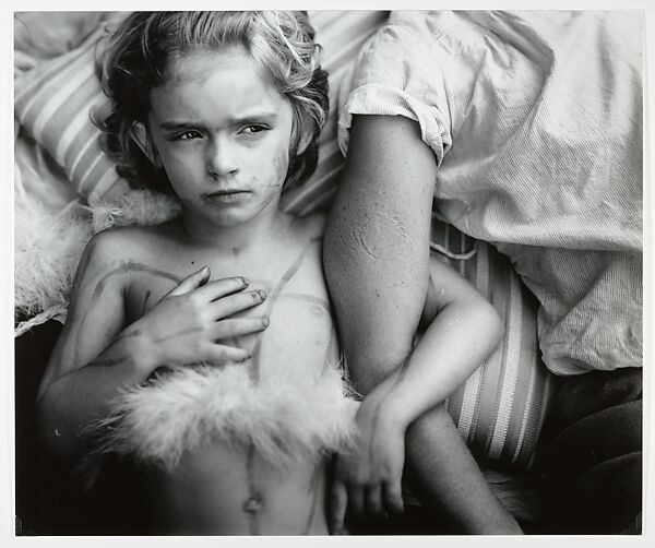 Jessie Bites, Sally Mann (American, born 1951), Gelatin silver print 