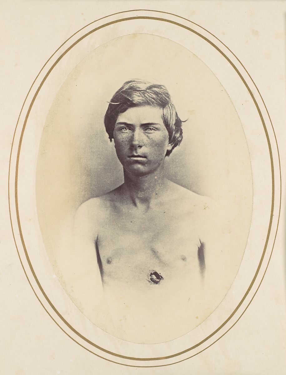 Frederick A. Bentley, Reed Brockway Bontecou (American, 1824–1907), Albumen silver print from glass negative 