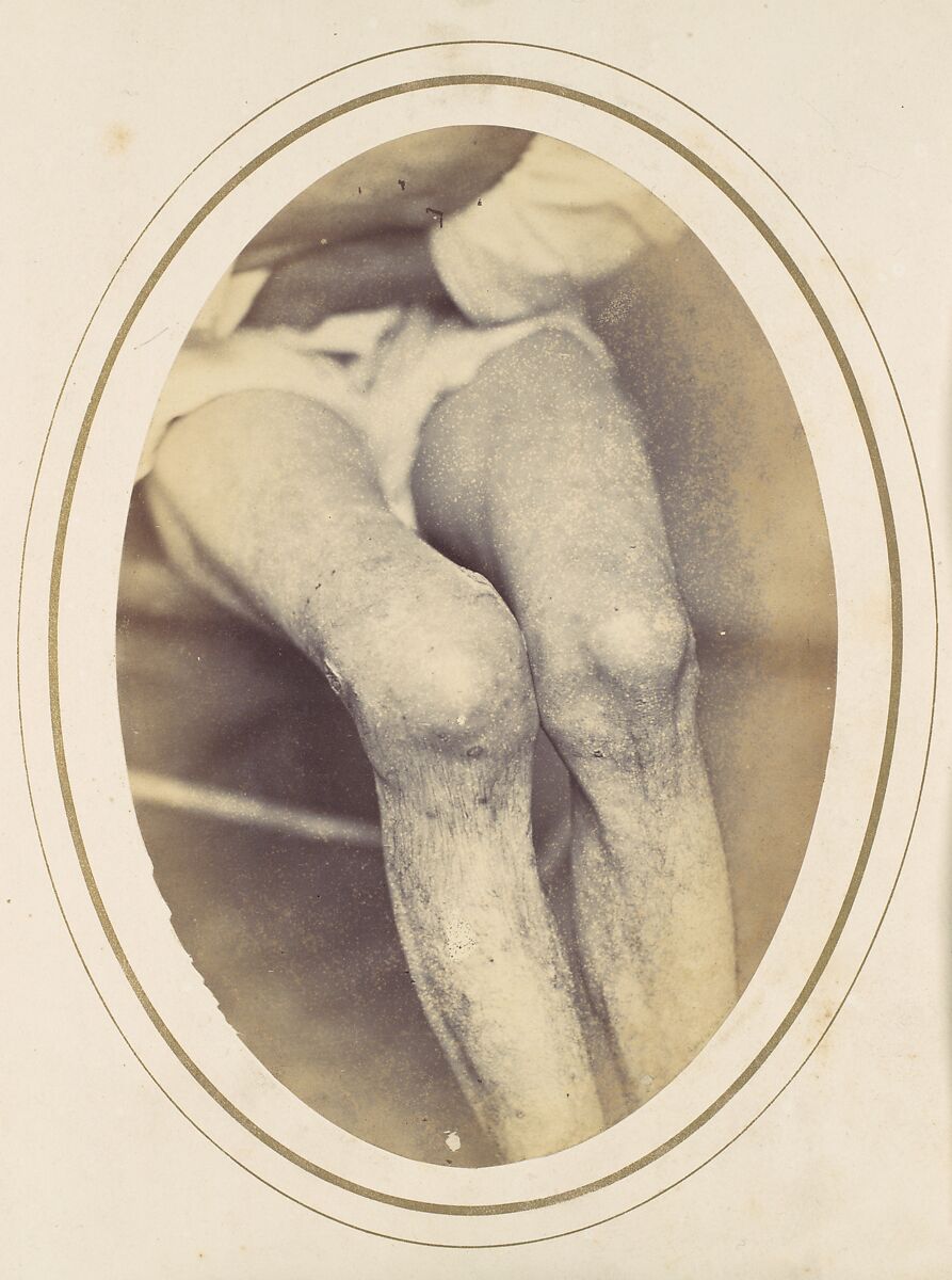 Frederick Hohmann, Reed Brockway Bontecou (American, 1824–1907), Albumen silver print from glass negative 