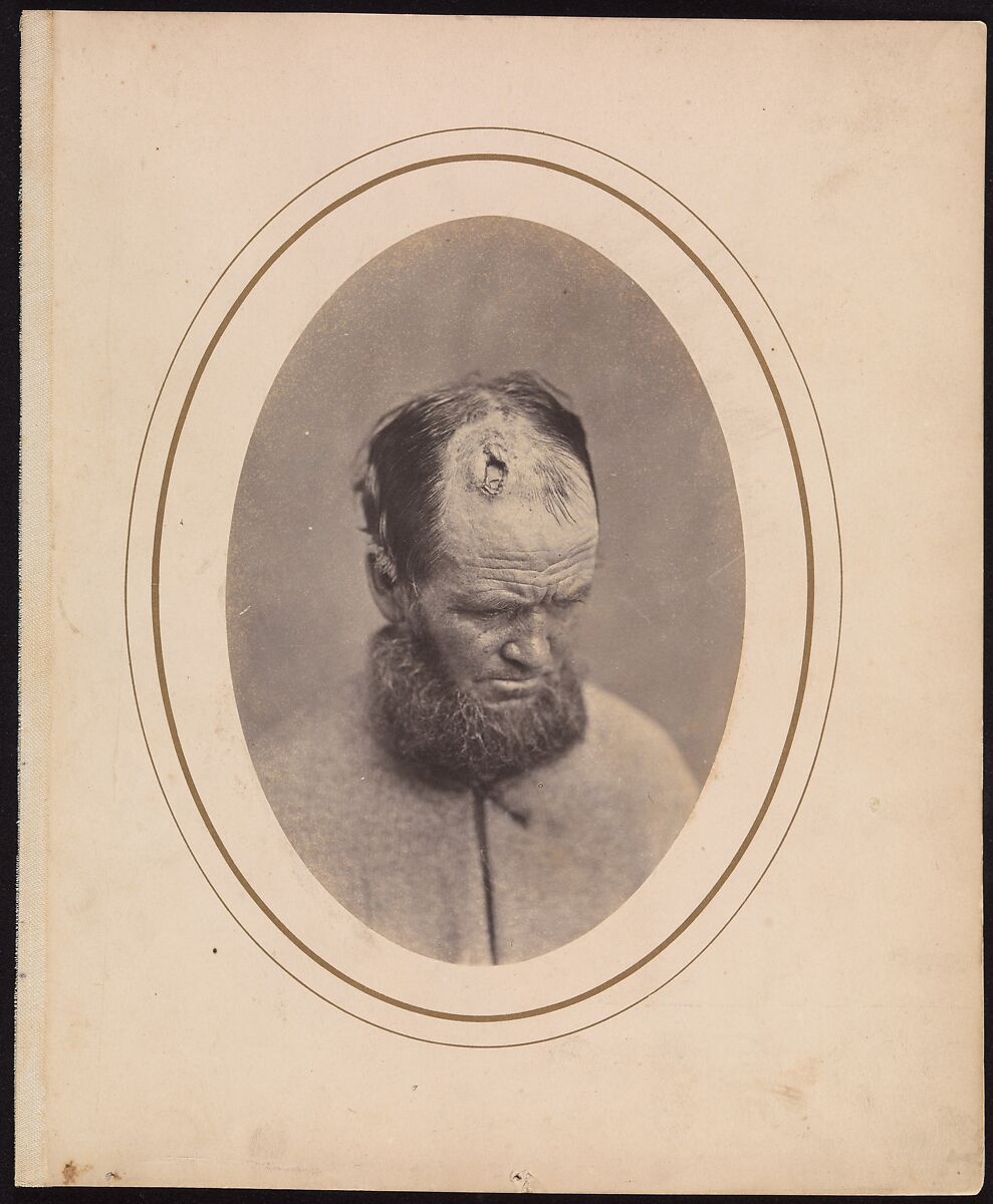 Private John Parkhurst, Company E, Second New York Heavy Artillery, Reed Brockway Bontecou (American, 1824–1907), Albumen silver print from glass negative 