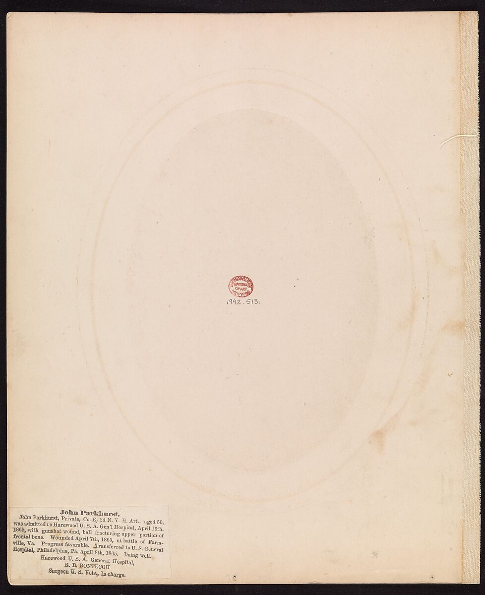 Private John Parkhurst, Company E, Second New York Heavy Artillery, Reed Brockway Bontecou (American, 1824–1907), Albumen silver print from glass negative