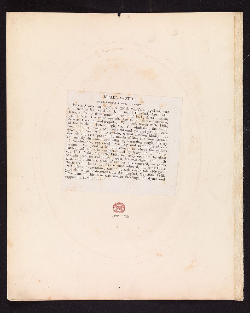 Corporal Israel Spotts, Company G, 200th Pennsylvania Volunteers, Reed Brockway Bontecou (American, 1824–1907), Albumen silver print from glass negative