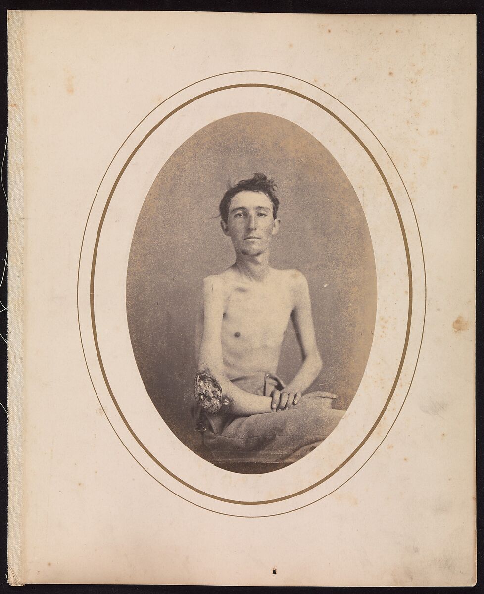Private James H. Stokes, Company H, 185th New York Volunteers, Reed Brockway Bontecou (American, 1824–1907), Albumen silver print from glass negative 