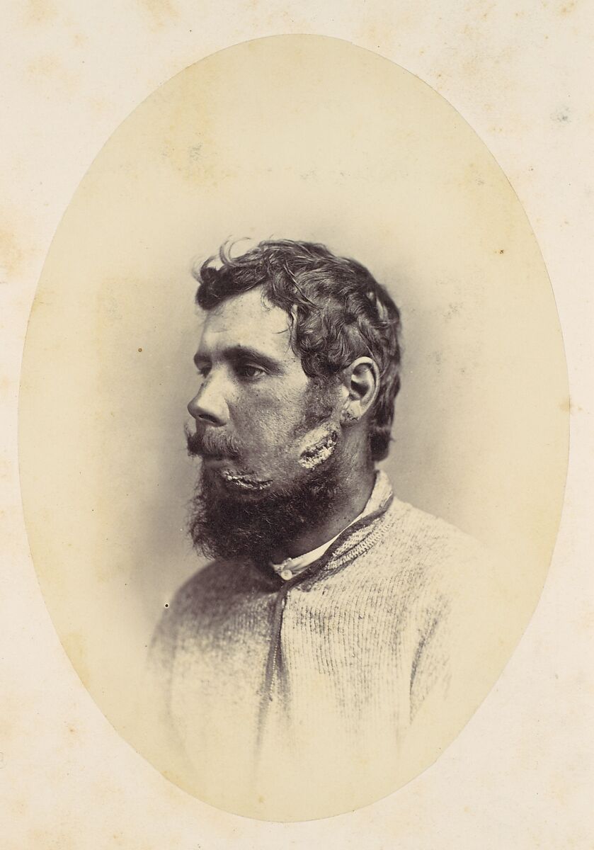 Andrew Wagoner, Reed Brockway Bontecou (American, 1824–1907), Albumen silver print from glass negative 