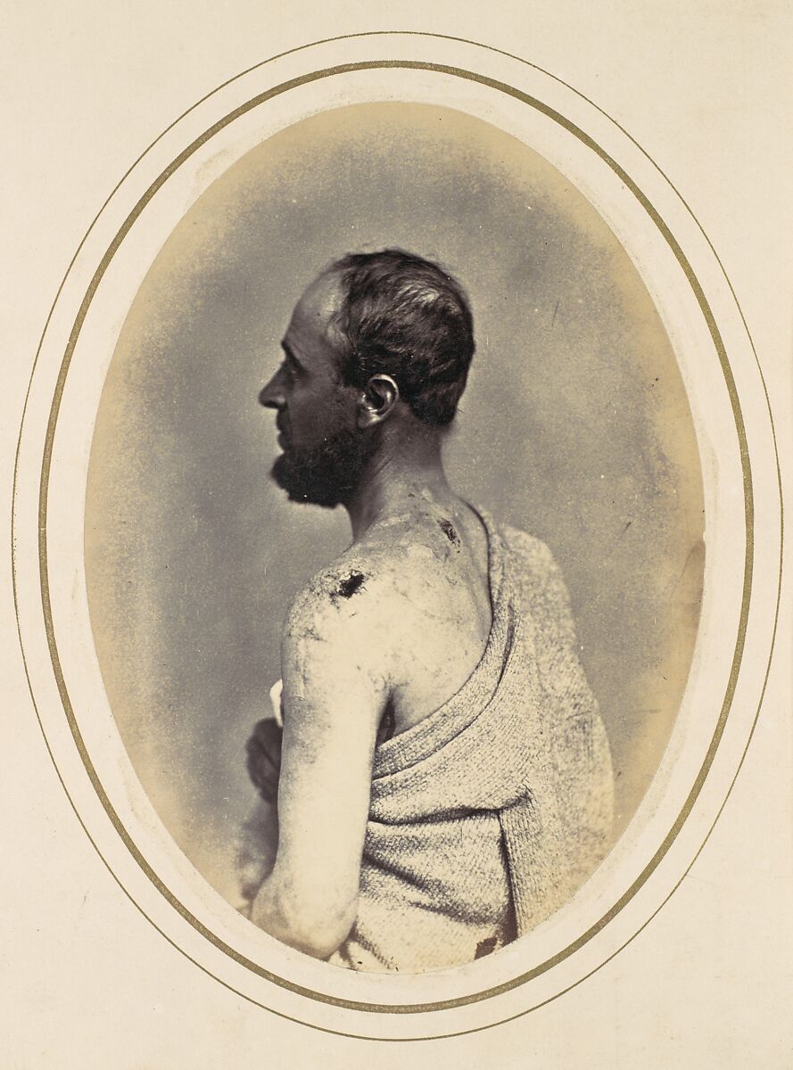 Henry Yon, Reed Brockway Bontecou (American, 1824–1907), Albumen silver print from glass negative 