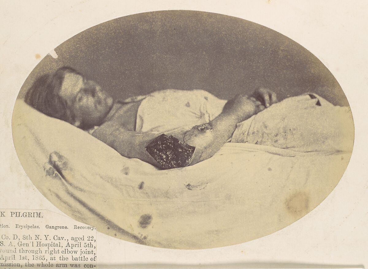 Frederick Pilgrim, Reed Brockway Bontecou (American, 1824–1907), Albumen silver print from glass negative 