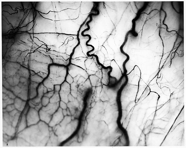 [Detail of Veins in Human Eyeball], Harold Edgerton (American, 1903–1990), Gelatin silver print 