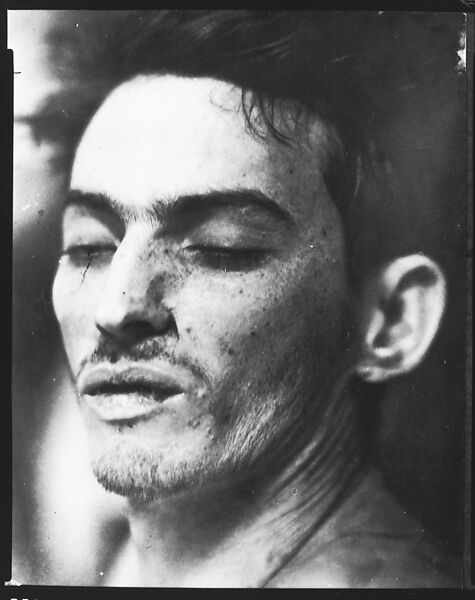 Walker Evans | [Copy of Newspaper File Photograph: Head of Corpse ...