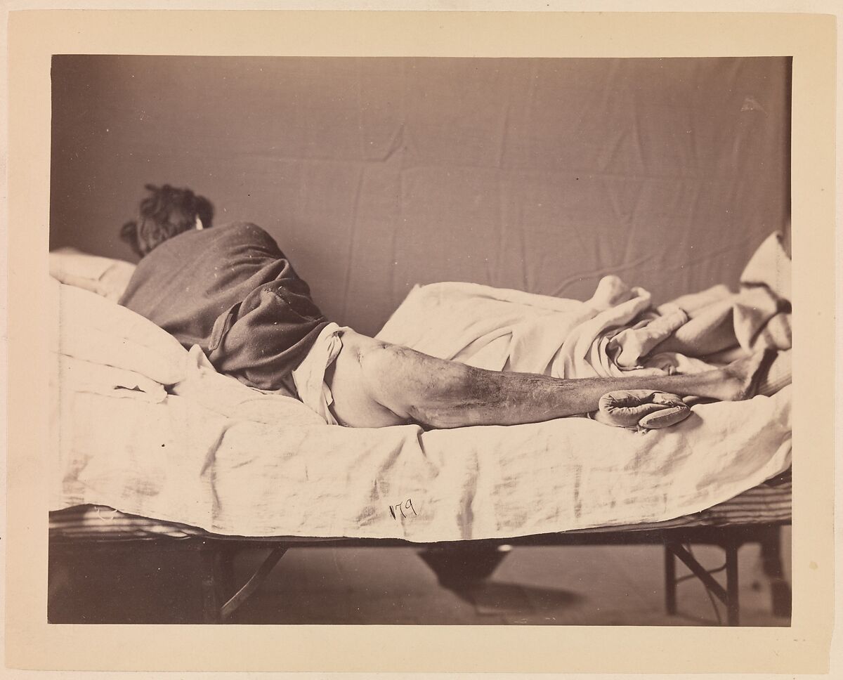 Private George Ruoss, Co. G, 7th New York Volunteers, Reed Brockway Bontecou (American, 1824–1907), Albumen silver print from glass negative 