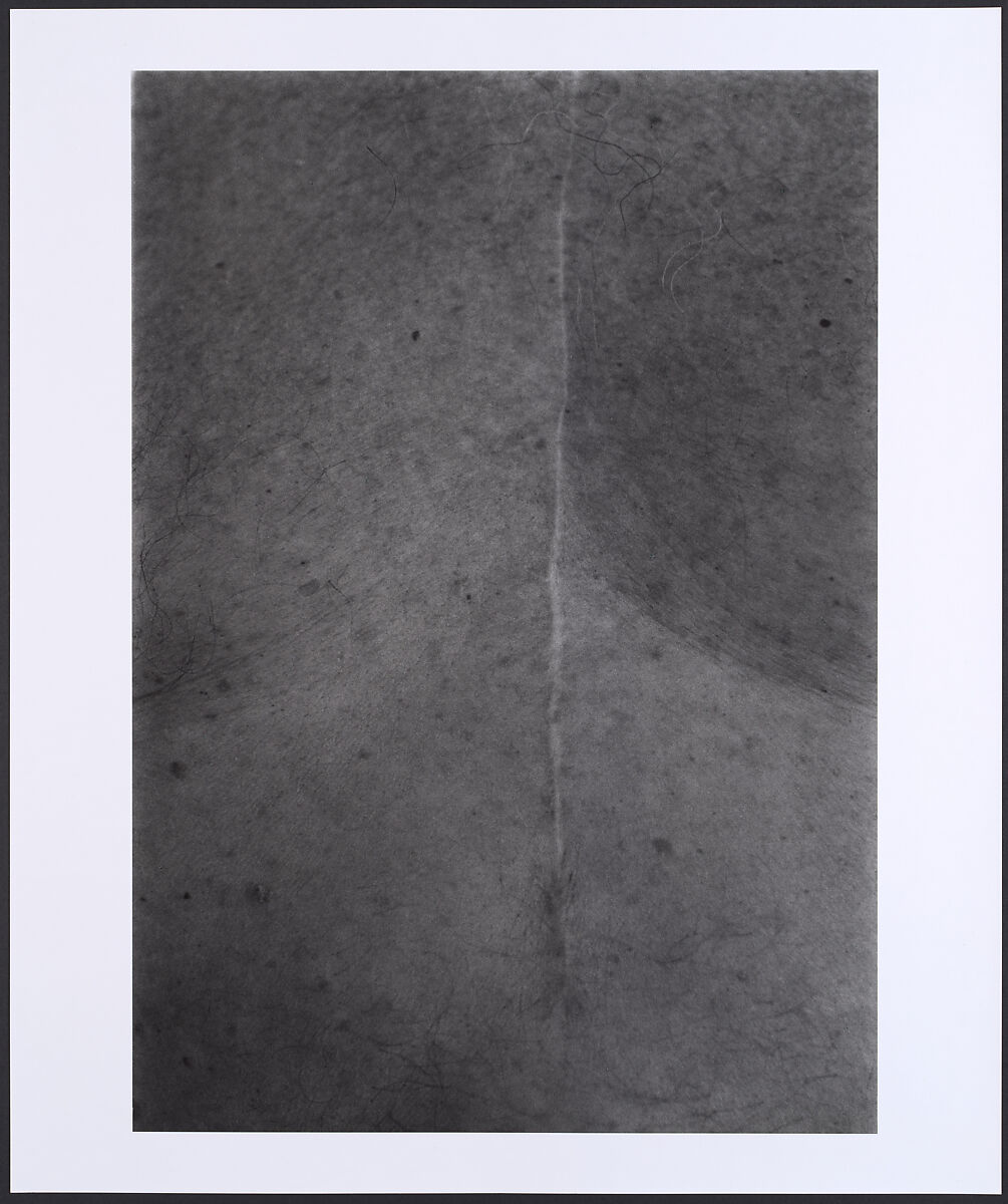 Scar #22, Illness-1984, New York, Ishiuchi Miyako (Japanese, born Gunma, 1947), Gelatin silver print 