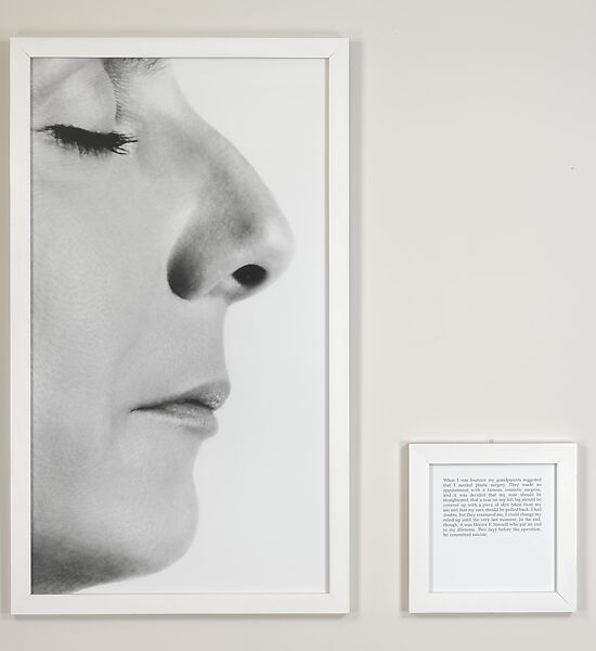 The Plastic Surgery, Sophie Calle (French, born Paris, 1953), Gelatin silver print 