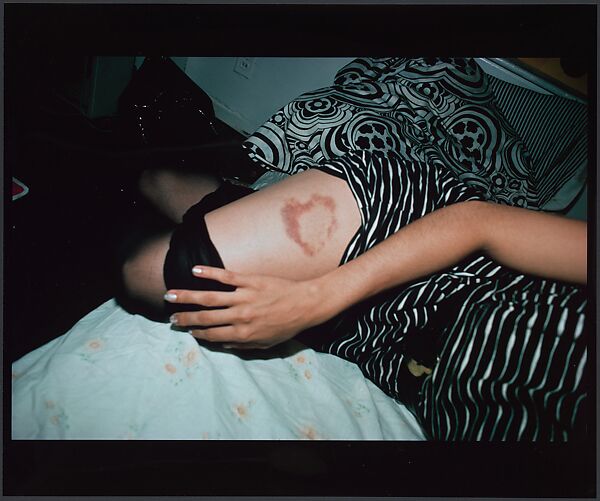 Heart-Shaped Bruise, NYC, Nan Goldin (American, born Washington, D.C., 1953), Silver dye bleach print 