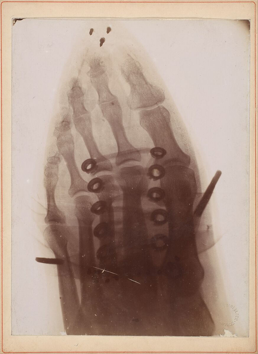 Le pied à travers la chaussure, Dr. Henri van Heurck (Belgian, 1838–1909), Gelatin silver print 