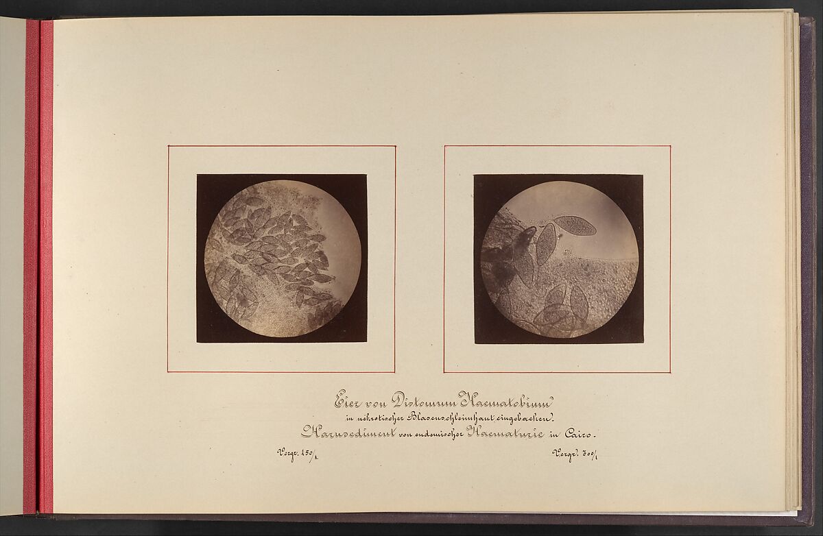 Mikroskopisch-Photographischer Atlas der Harnsedimente, Robert Ultzmann (Austrian, 1842–1889), Albumen silver prints 
