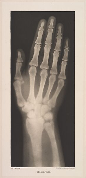 Versuche über Photographie mittelst der Röntgen'schen Strahlen, Josef Maria Eder (Austrian, Krems an der Donau, 1855–1944 Kitzbühel) and, Photogravures