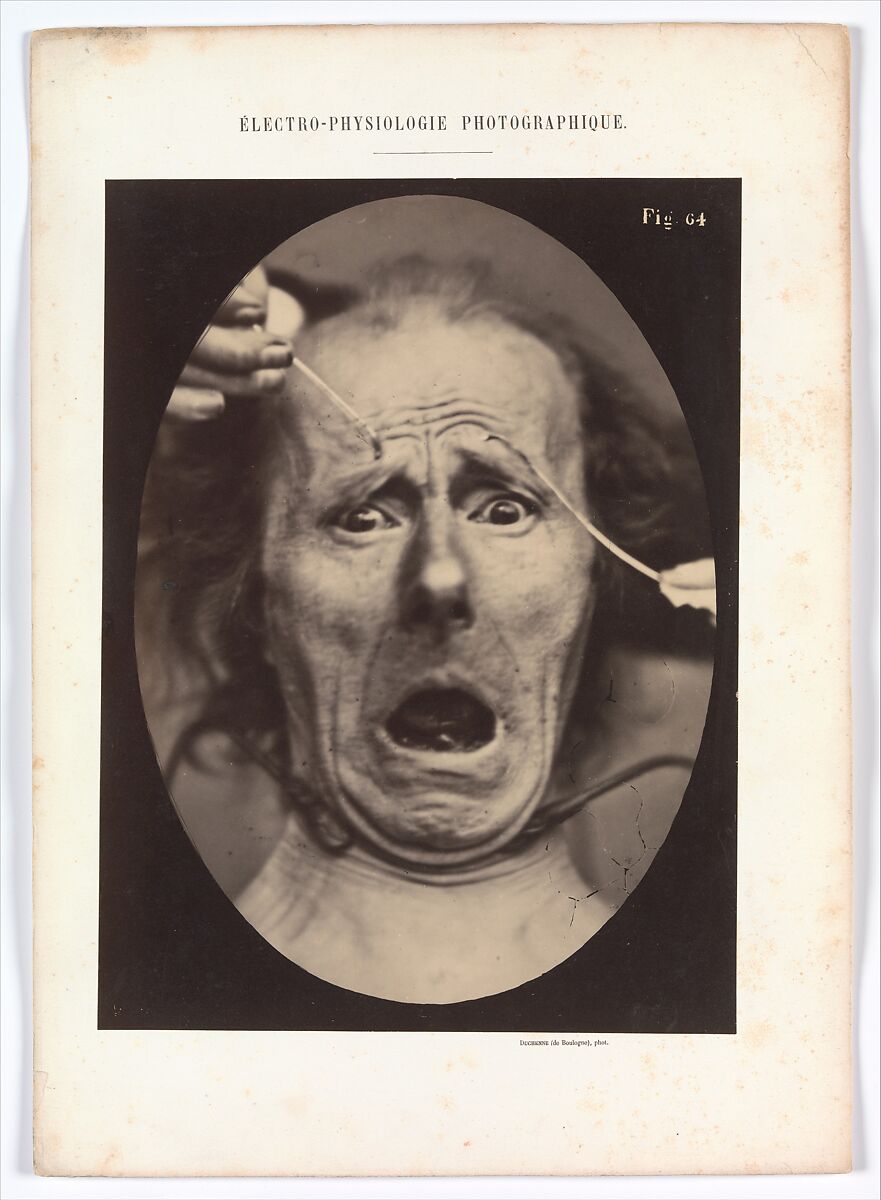 Electro–Physiologie, Figure 64, Adrien Tournachon (French, 1825–1903), Albumen silver print from glass negative 