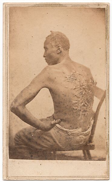 The Scourged Back, Attributed to McPherson &amp; Oliver (American, active New Orleans and Baton Rouge, Louisiana, 1860s), Albumen silver print from glass negative 