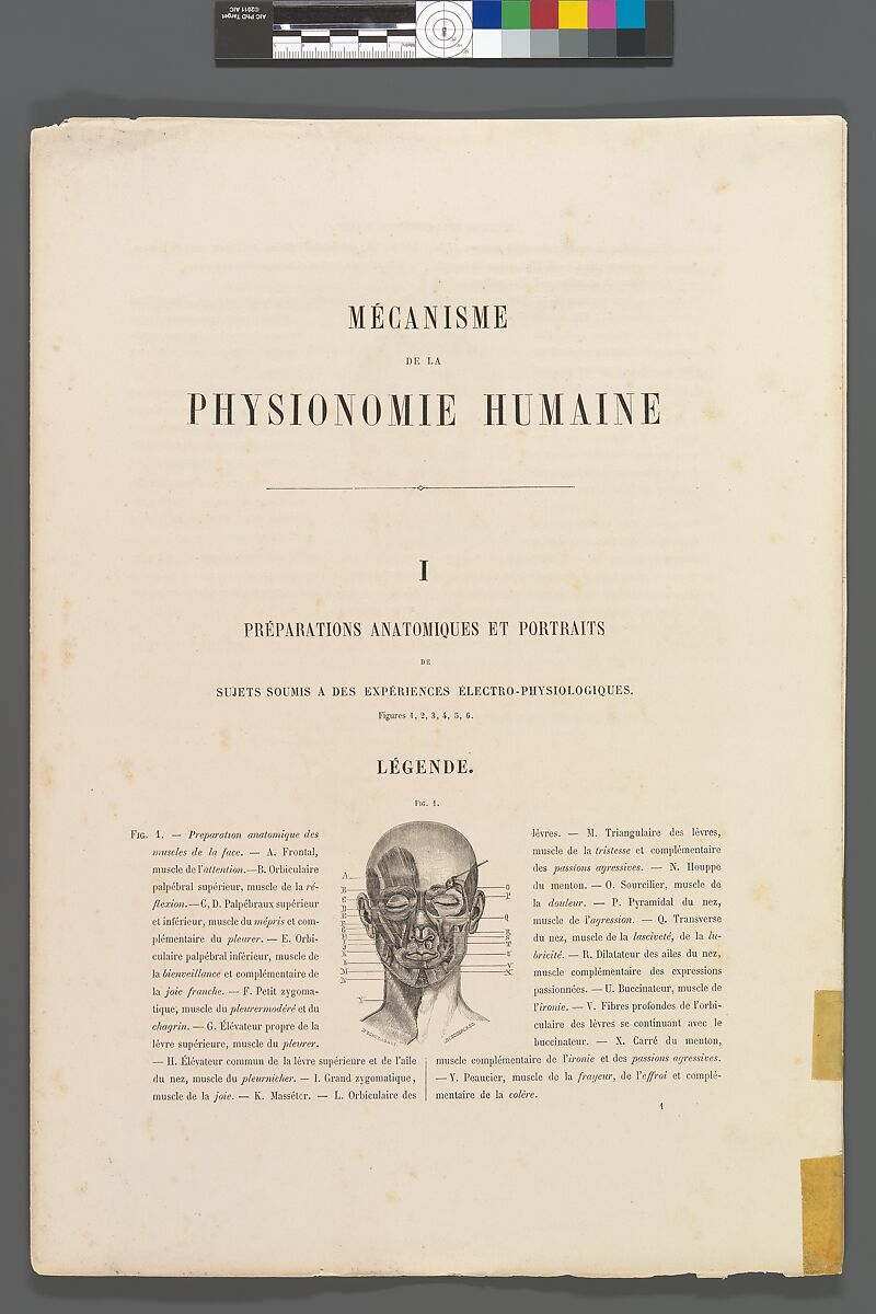 Mécanisme de la physionomie humaine ou Analyse électro-physiologique de l’expression des passions applicable à la pratique des arts plastiques, Guillaume-Benjamin-Amand Duchenne de Boulogne (French, 1806–1875), Albumen silver prints from glass negatives