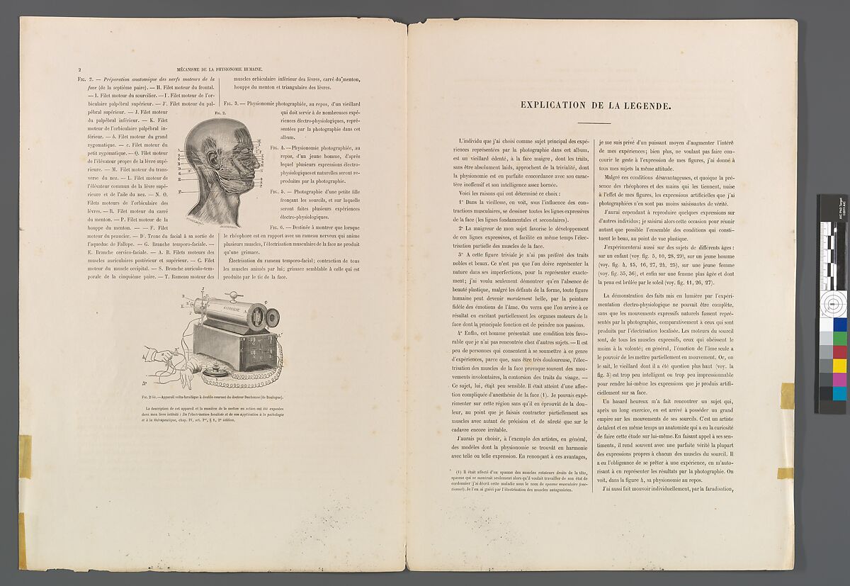 Mécanisme de la physionomie humaine ou Analyse électro-physiologique de l’expression des passions applicable à la pratique des arts plastiques, Guillaume-Benjamin-Amand Duchenne de Boulogne (French, 1806–1875), Albumen silver prints from glass negatives