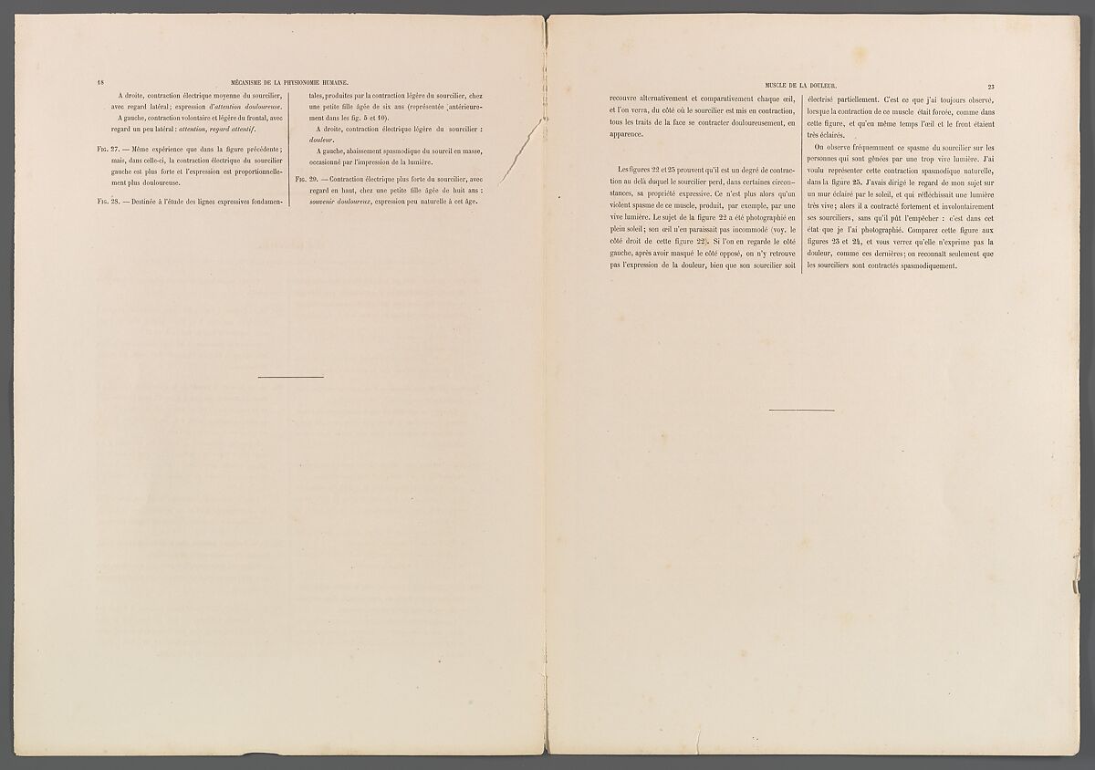 Mécanisme de la physionomie humaine ou Analyse électro-physiologique de l’expression des passions applicable à la pratique des arts plastiques, Guillaume-Benjamin-Amand Duchenne de Boulogne (French, 1806–1875), Albumen silver prints from glass negatives