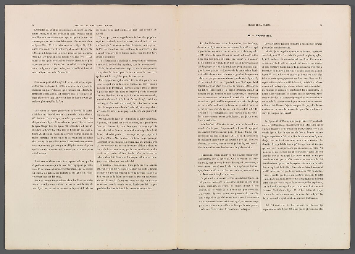 Mécanisme de la physionomie humaine ou Analyse électro-physiologique de l’expression des passions applicable à la pratique des arts plastiques, Guillaume-Benjamin-Amand Duchenne de Boulogne (French, 1806–1875), Albumen silver prints from glass negatives