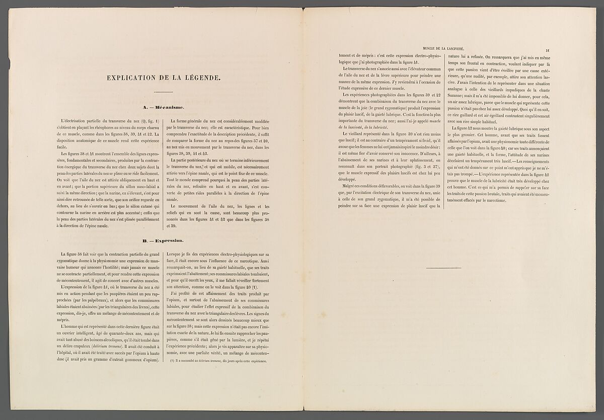 Mécanisme de la physionomie humaine ou Analyse électro-physiologique de l’expression des passions applicable à la pratique des arts plastiques, Guillaume-Benjamin-Amand Duchenne de Boulogne (French, 1806–1875), Albumen silver prints from glass negatives