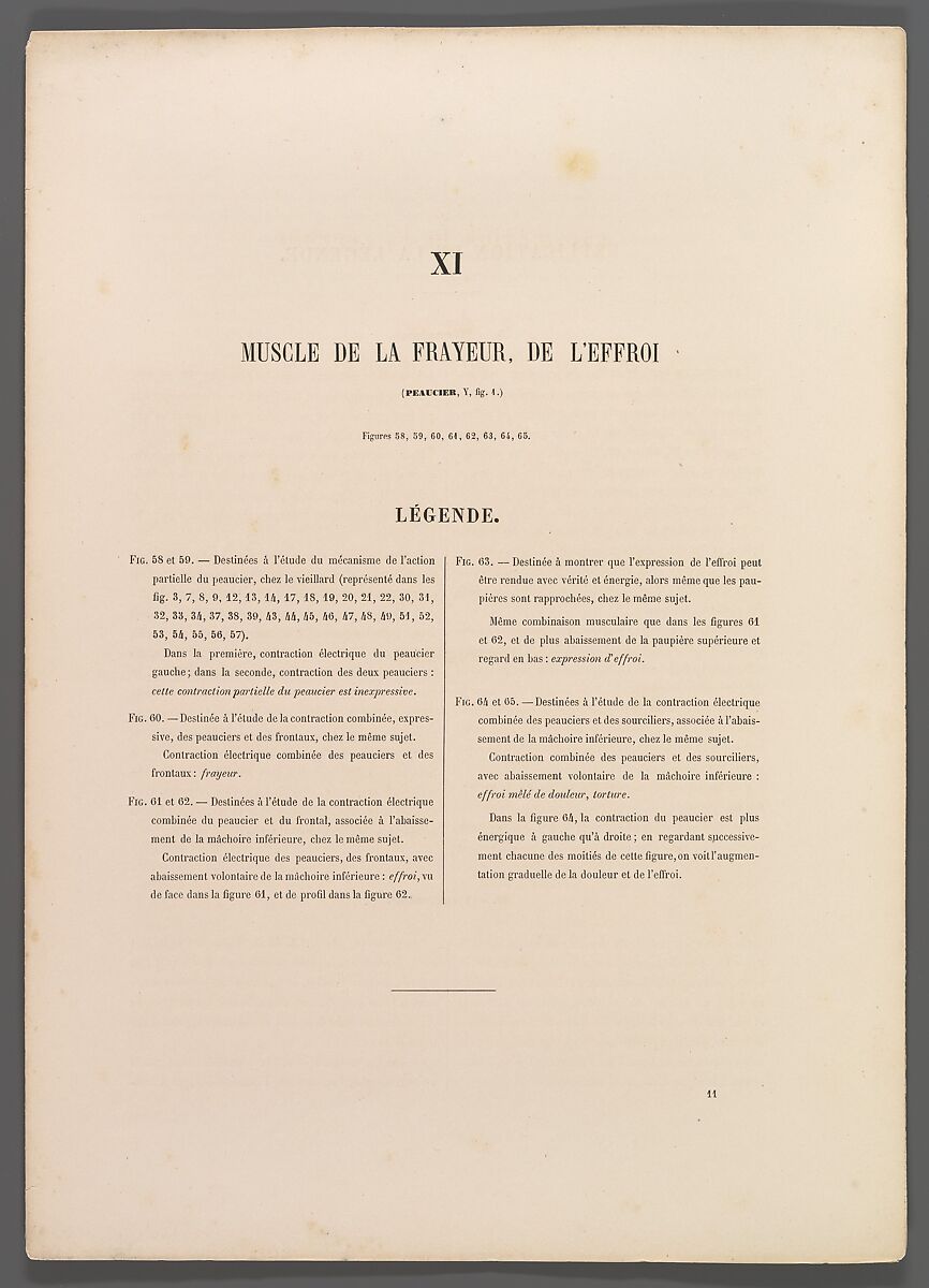 Mécanisme de la physionomie humaine ou Analyse électro-physiologique de l’expression des passions applicable à la pratique des arts plastiques, Guillaume-Benjamin-Amand Duchenne de Boulogne (French, 1806–1875), Albumen silver prints from glass negatives