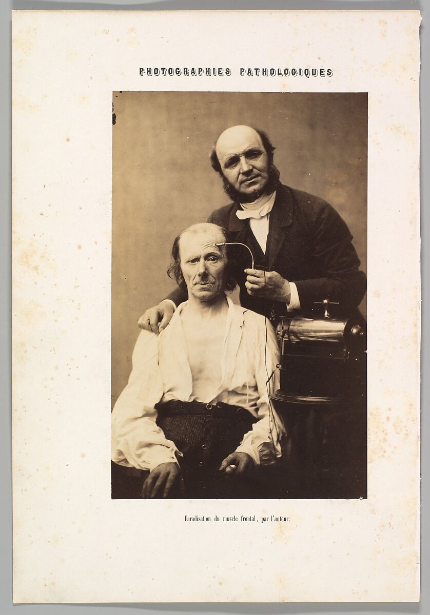 Faradisation du muscle frontal, Guillaume-Benjamin-Amand Duchenne de Boulogne (French, 1806–1875), Albumen silver print from glass negative 