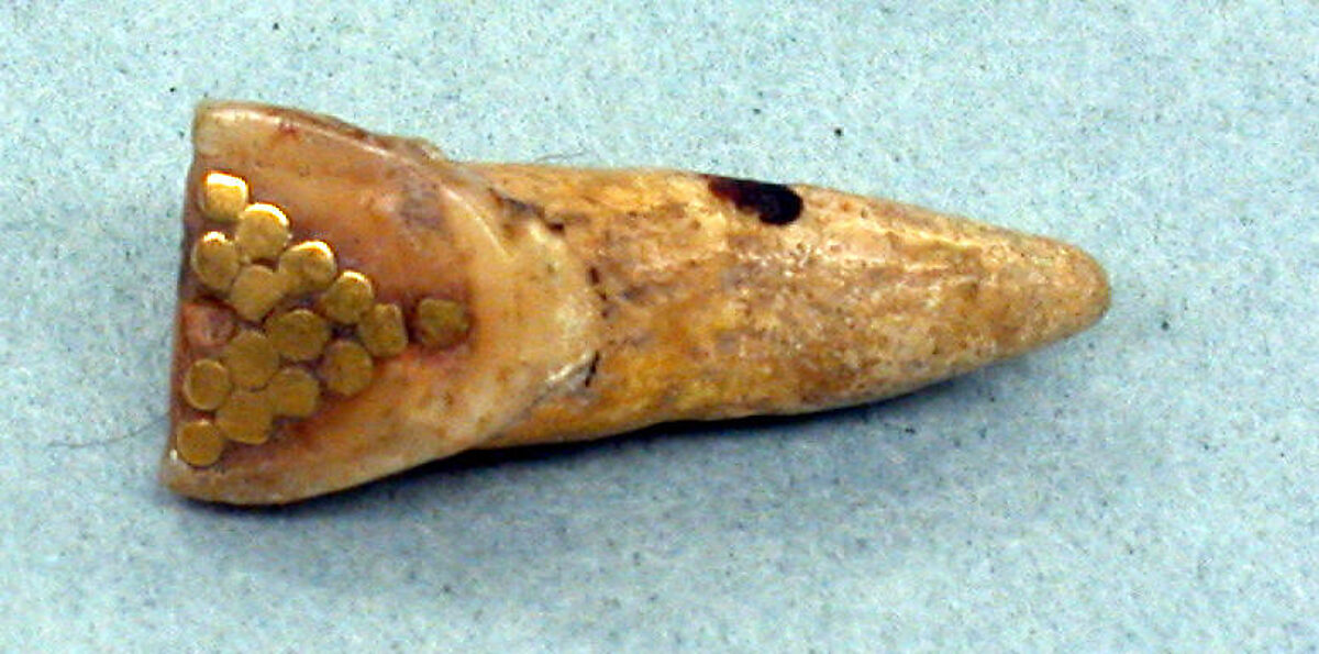 Inlaid Tooth, Human tooth, gold, Visayes or Mindanao 