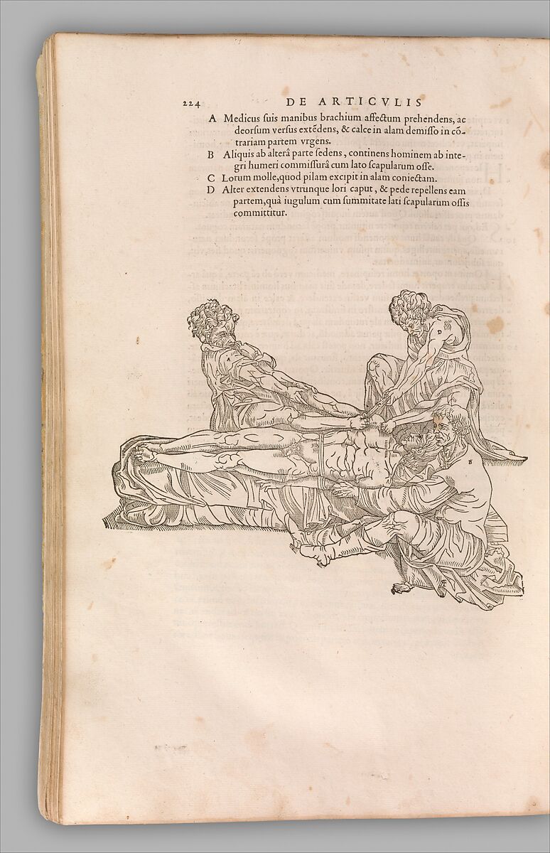 Chirurgia è Graeco in Latinum conversa, Vido Vidio Florentino interprete, Guido Guidi (Florence 1509–1569 Pisa), Printed book with 210 woodcut illustrations