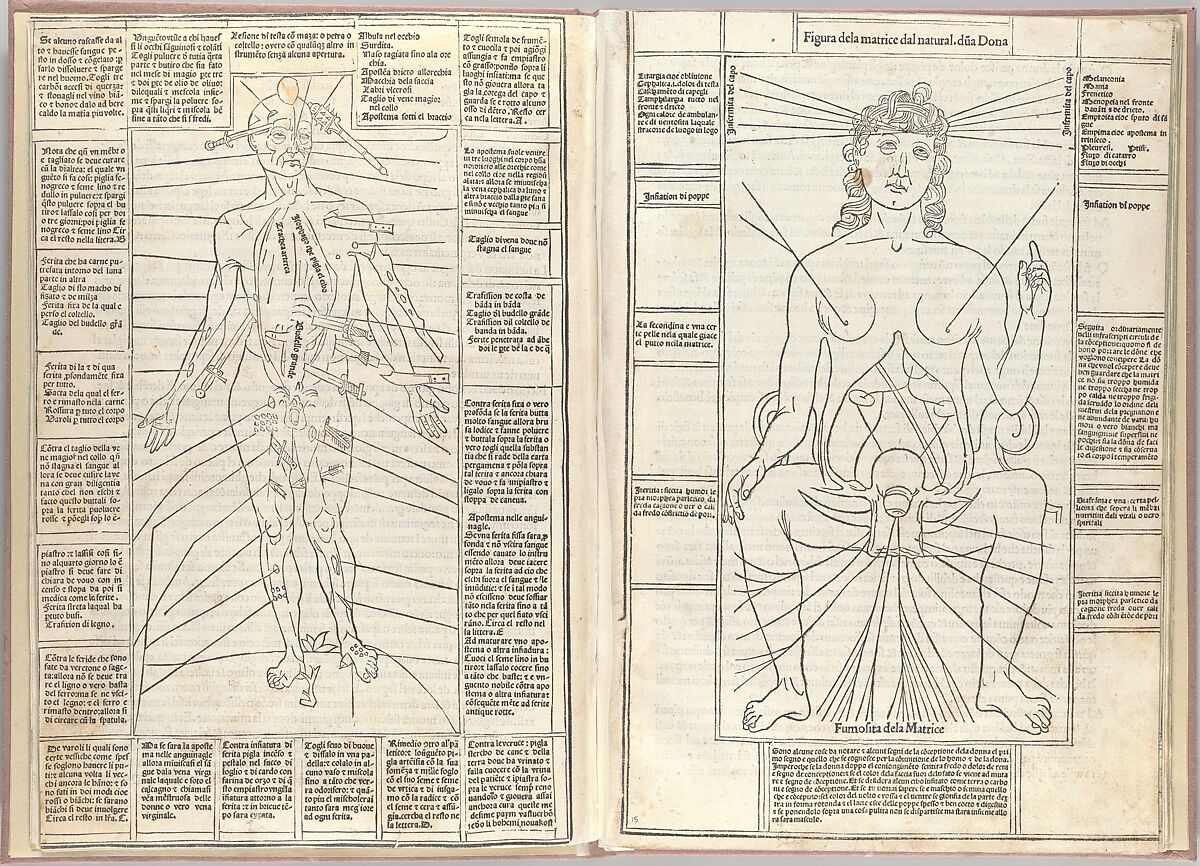 Fasciculo di medicina, Possibly Johannes de Ketham (German, active 15th century), Woodcut