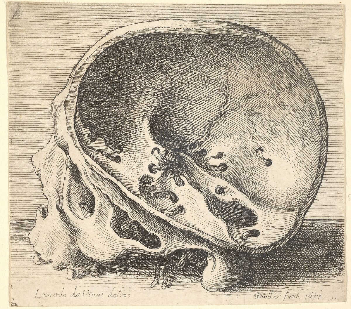 Sectioned skull in profile to left with the left side of the cranium removed, Wenceslaus Hollar (Bohemian, Prague 1607–1677 London), Etching: only state 