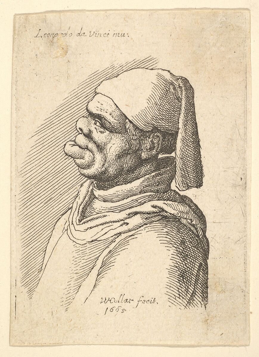 Bust of a deformed man with a hat and a fat, protruding lower lip in profile to left, Wenceslaus Hollar (Bohemian, Prague 1607–1677 London), Etching; only state 