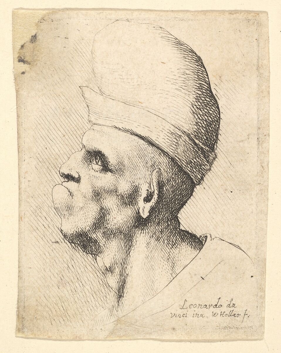 Bust of a deformed man wearing a bulbous hat in profile to the left, Wenceslaus Hollar (Bohemian, Prague 1607–1677 London), Etching; only state 