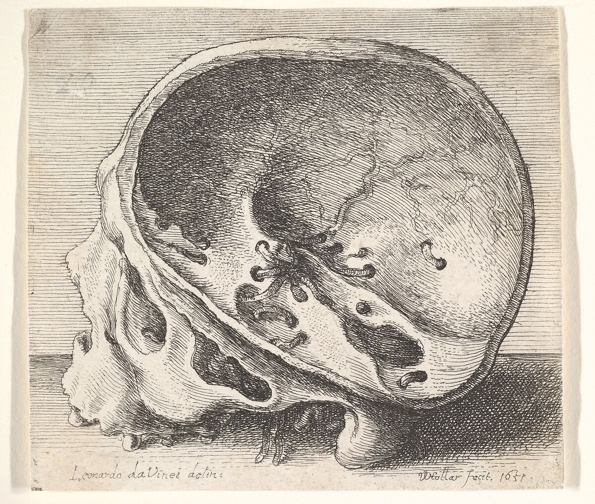 Sectioned skull in profile to left with the left side of the cranium removed, Wenceslaus Hollar (Bohemian, Prague 1607–1677 London), Etching; only state 