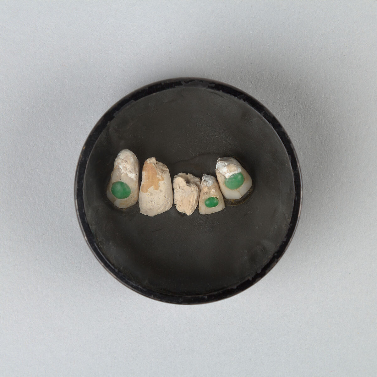 Human tooth inlaid with jadeite, Jadeite, pea-green, Mexico 