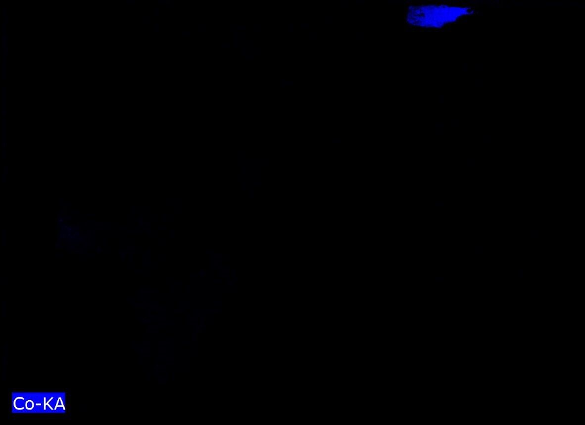 Cephalus and Procris, Godfried Schalcken (Dutch, Made 1643–1706 The Hague), Oil on canvas