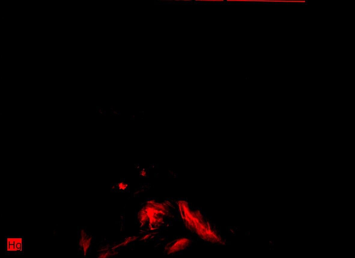 Cephalus and Procris, Godfried Schalcken (Dutch, Made 1643–1706 The Hague), Oil on canvas