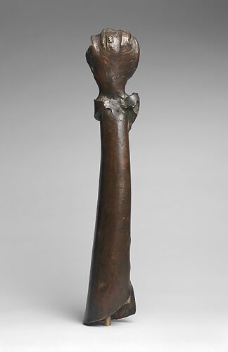 Arm