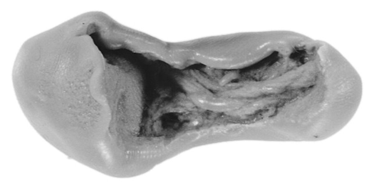 Sealing, Clay (unfired)