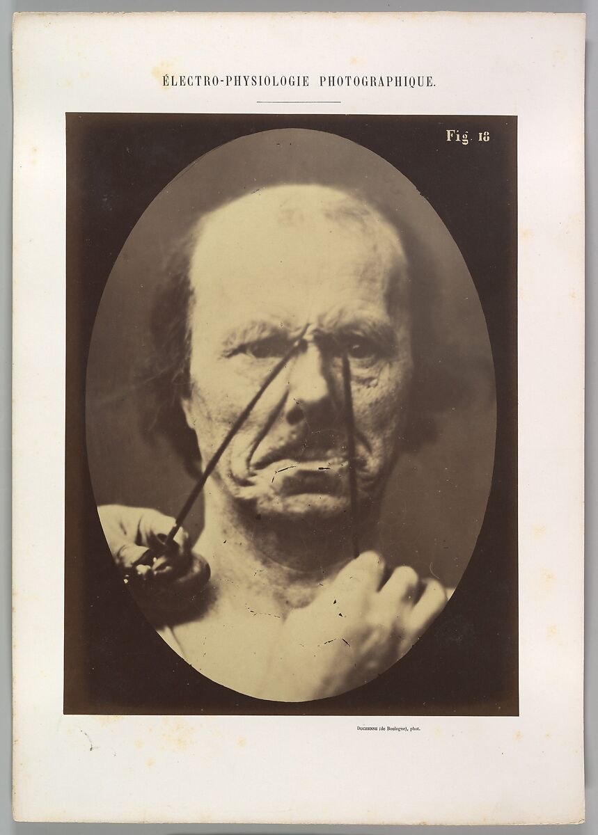 Figure 18: Aggression, wickedness, Guillaume-Benjamin-Amand Duchenne de Boulogne (French, 1806–1875), Albumen silver print from glass negative 