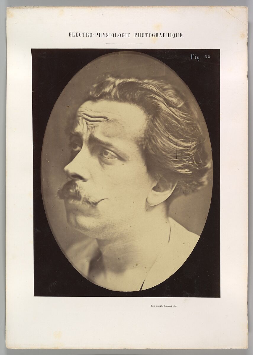 Figure 25: Not an expression of pain, Guillaume-Benjamin-Amand Duchenne de Boulogne (French, 1806–1875), Albumen silver print from glass negative 