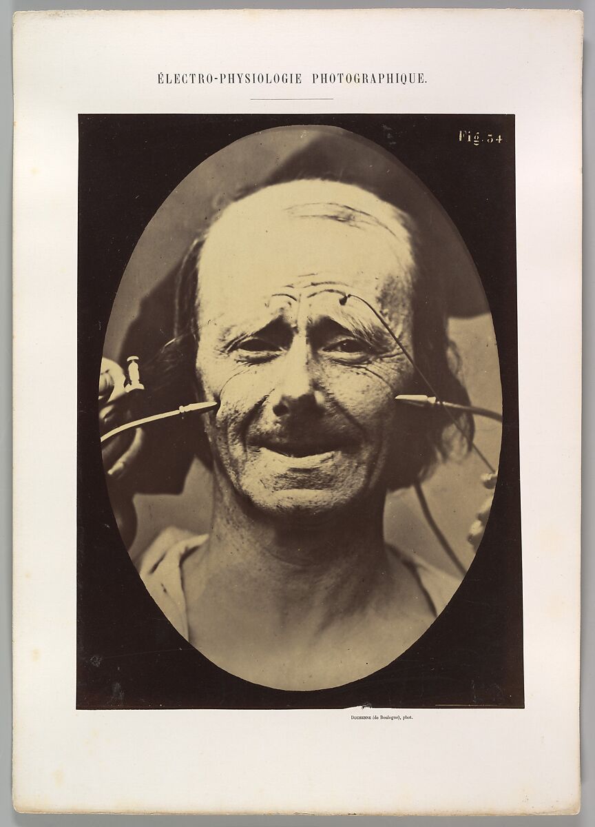 Figure 34: Grimace, Guillaume-Benjamin-Amand Duchenne de Boulogne (French, 1806–1875), Albumen silver print from glass negative 