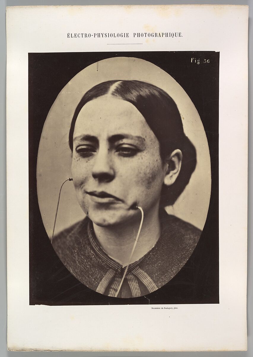 Figure 36: Scornful laughter and scornful disgust, Guillaume-Benjamin-Amand Duchenne de Boulogne (French, 1806–1875), Albumen silver print from glass negative 