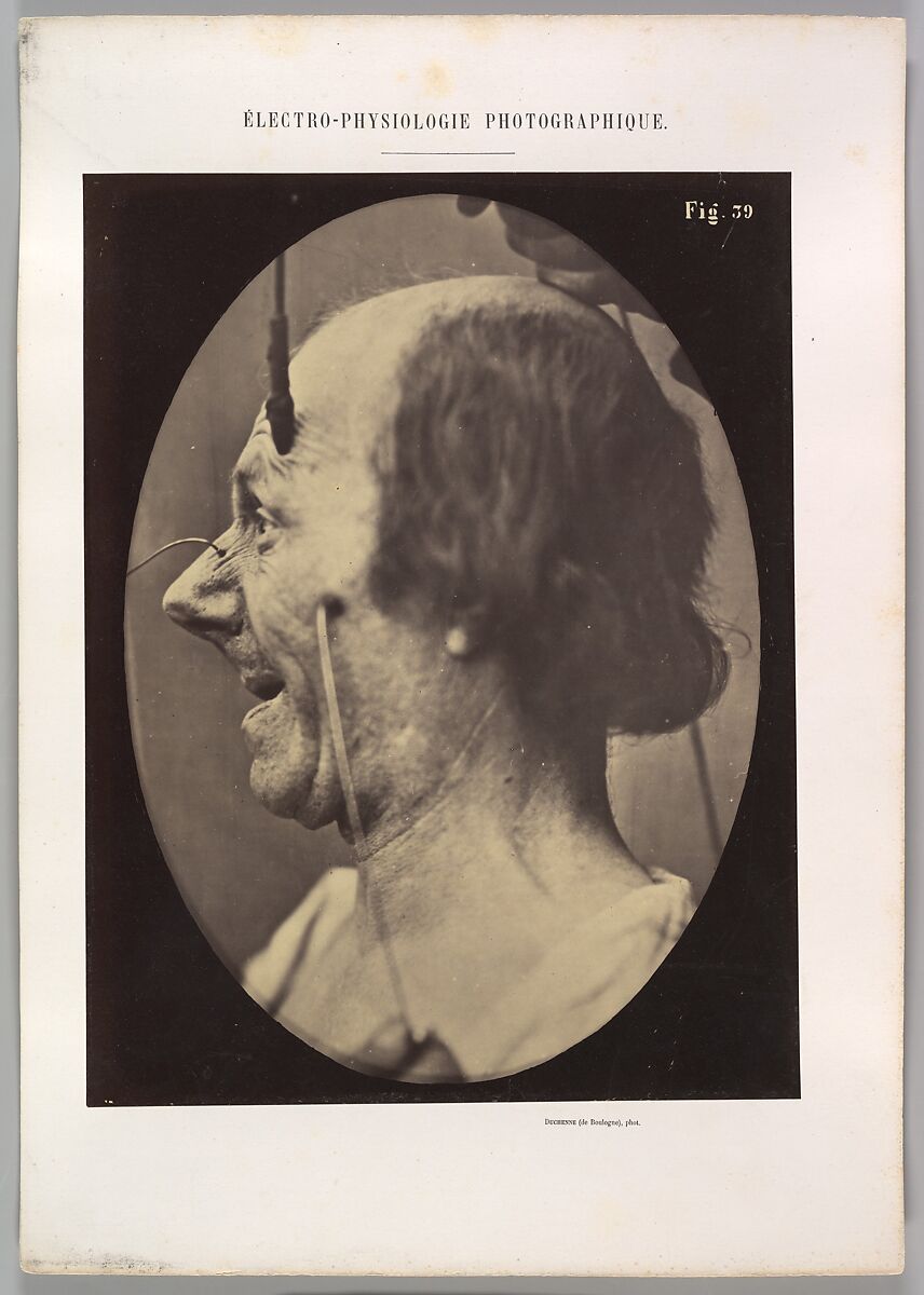 Figure 39: The  attention attracted by an object that provokes lascivious ideas and desires., Guillaume-Benjamin-Amand Duchenne de Boulogne (French, 1806–1875), Albumen silver print from glass negative 
