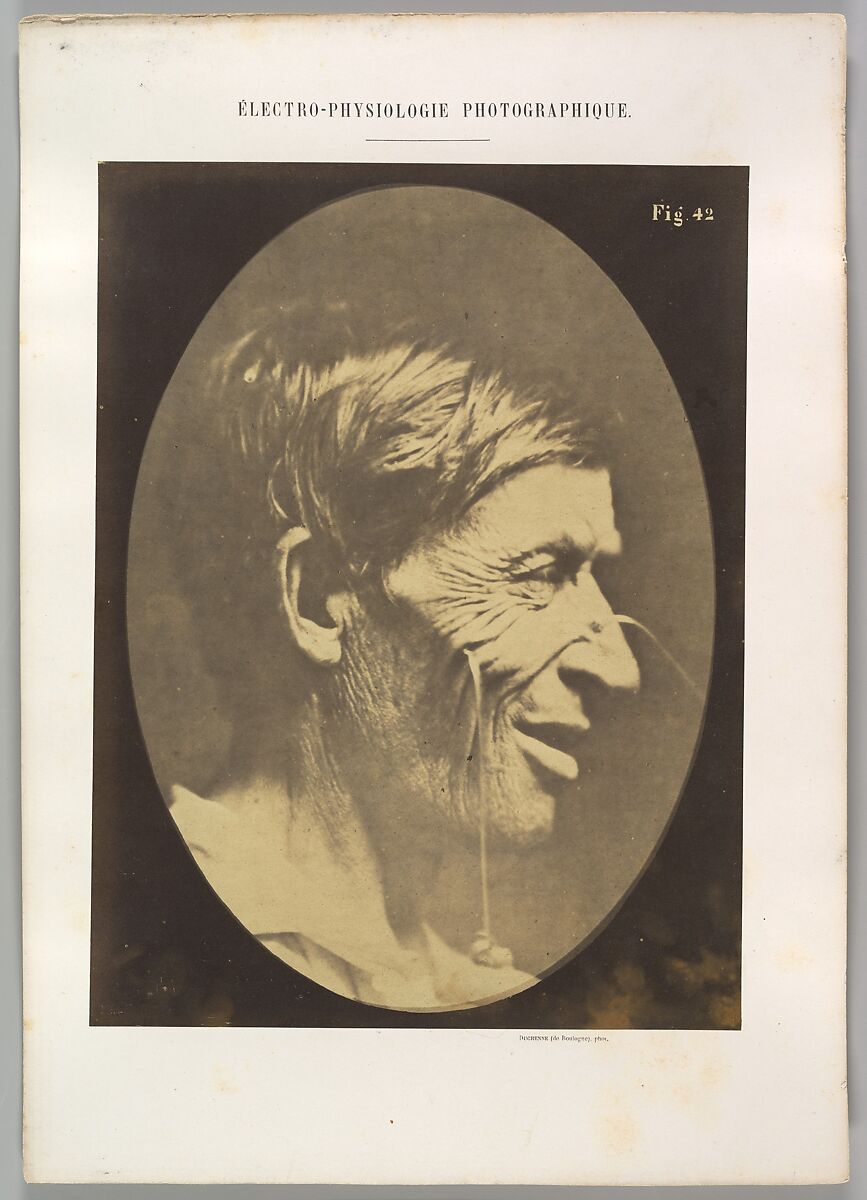 Figure 42: Gaiety expressed by the ideas of lustfulness, cynicism, and lewdness., Guillaume-Benjamin-Amand Duchenne de Boulogne (French, 1806–1875), Albumen silver print from glass negative 