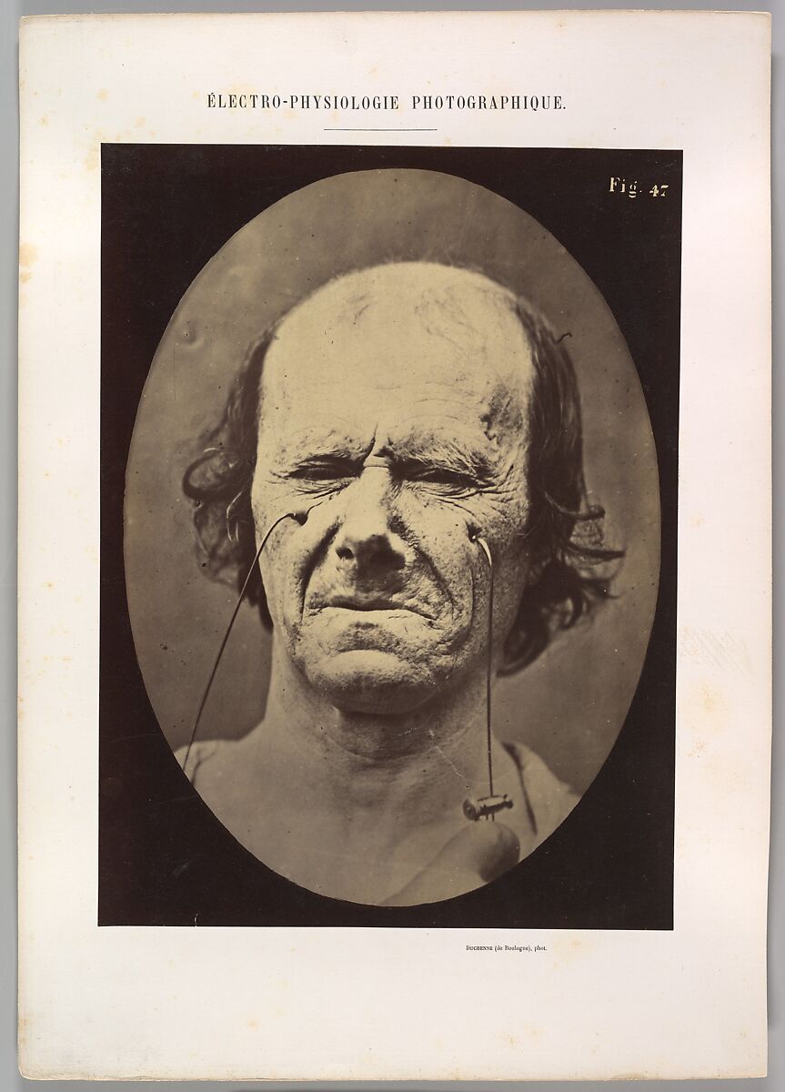 Figure 47: A suggestion of this same weeping, Guillaume-Benjamin-Amand Duchenne de Boulogne (French, 1806–1875), Albumen silver print from glass negative 
