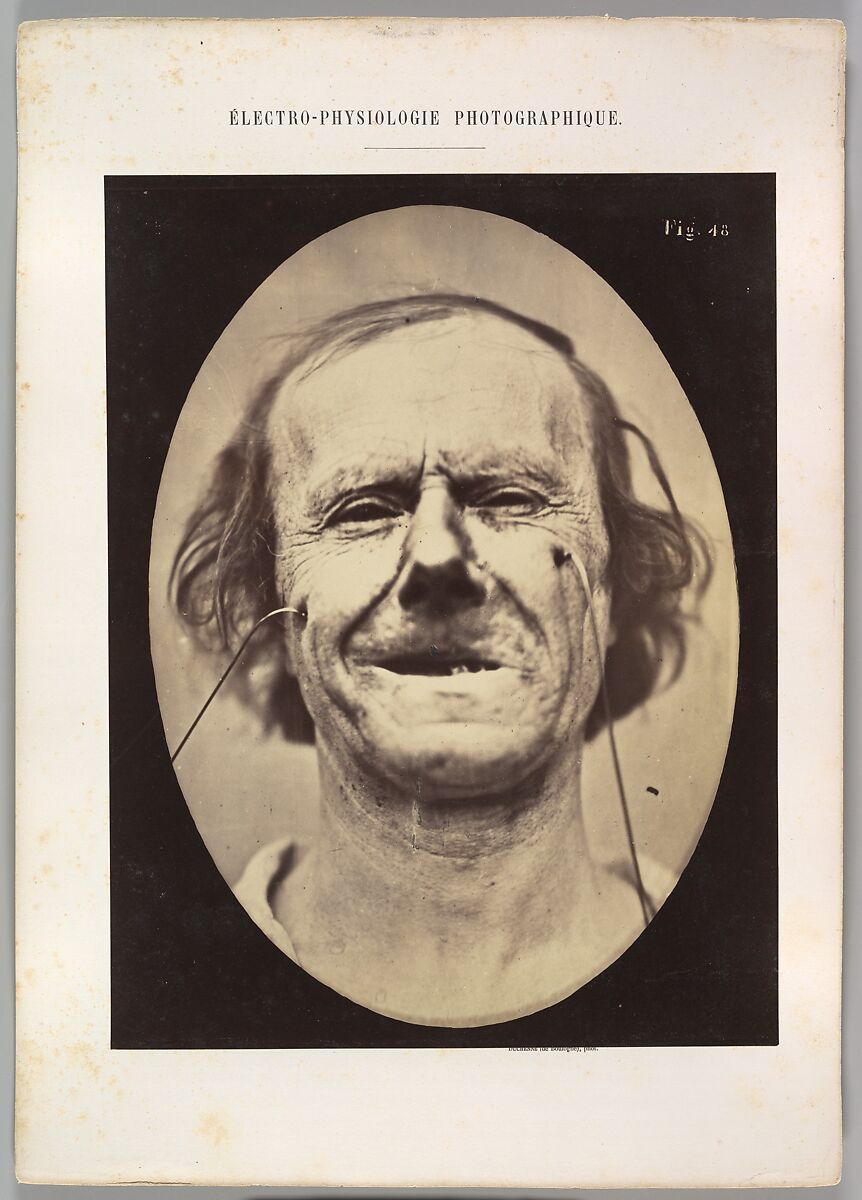 Figure 48: Mild weeping, pity and feeble false laughter, Guillaume-Benjamin-Amand Duchenne de Boulogne (French, 1806–1875), Albumen silver print from glass negative 